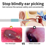 Wireless Smart Vision Ear Stick Ear Scoop Ear Picker 300W/500W